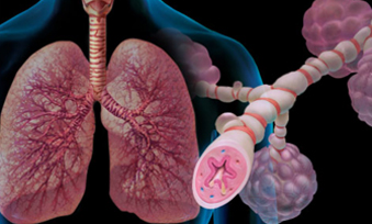 ASTHMA