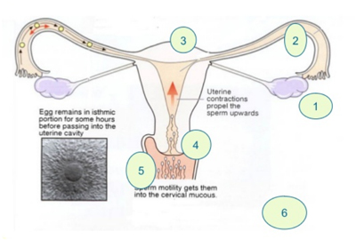 FEMALE INFERTILITY